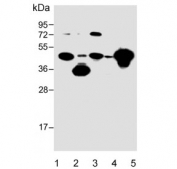 Western blot testing of 1) human 293, 2) human HepG2, 3) human MOLT-4, 4) mouse NIH 3T3 and 5) mouse brain lysate with STRADA antibody. Predicted molecular weight ~48 kDa.