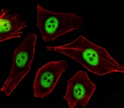 Immunofluorescent staining of fixed and permeabilized human A549 cells with CDKN1A antibody (green) and anti-Actin (red).