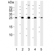 Western blot testing of human 1) HeLa, 2) HUVEC, 3) MCF7, 4) SH-SY5Y and 5) mouse lung lysate with CDKN1A antibody.