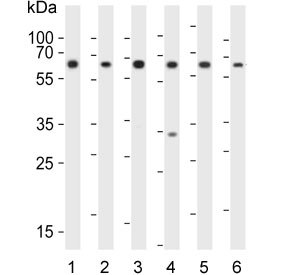 Western blot testing of human 1) K562, 2) Jurkat, 3) HL60, 4) HepG2, 5) kidney and 6) placenta lysate with Erythropoietin Receptor antibody. Predicted molecular weight ~55 kDa.~