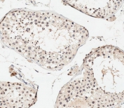 IHC testing of FFPE human testis tissue with UBE4B antibody. HIER: steam section in pH6 citrate buffer for 20 min and allow to cool prior to staining.
