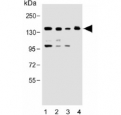 Western blot testing of human 1) K562, 2) Raji, 3) HeLa and 4) NIH 3T3 lysate with UBE4B antibody. Predicted molecular weight ~146 kDa.