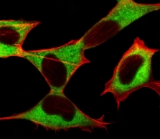 Immunofluorescent staining of fixed and permeabilized human SH-SY5Y cells with STMN2 antibody (green) and anti-Actin (red).