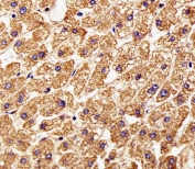 IHC testing of FFPE human liver tissue with STMN2 antibody. HIER: steam section in pH6 citrate buffer for 20 min and allow to cool prior to staining.
