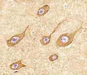 IHC testing of FFPE human brain tissue with STMN2 antibody. HIER: steam section in pH6 citrate buffer for 20 min and allow to cool prior to staining.