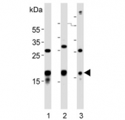 Western blot testing of 1) human brain, 2) mouse brain and 3) SH-SY5Y lysate with STMN2 antibody. Predicted molecular weight ~21 kDa.