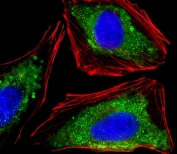 Immunofluorescent staining of fixed and permeabilized human HeLa cells with Integrin alpha 7 antibody (green), DAPI nuclear stain (blue) and anti-Actin (red).