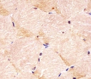 IHC testing of FFPE human skeletal muscle tissue with Integrin alpha 7 antibody. HIER: steam section in pH6 citrate buffer for 20 min and allow to cool prior to staining.