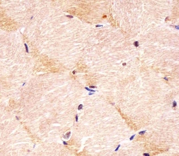 IHC testing of FFPE human skeletal muscle tissue with Integrin alpha 7 antibody. HIER: steam section in pH6 citrate buffer for 20 min and allow to cool prior to staining.