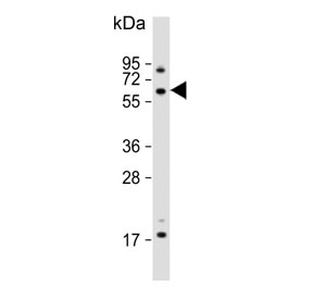 Western blot testing of human HCT-116 cell lysate with USP14 antibody. Predicted molecular weight ~56 kDa.
