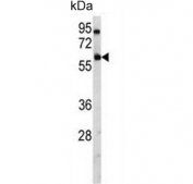 Western blot testing of human A2058 cell lysate with USP14 antibody. Predicted molecular weight ~56 kDa.