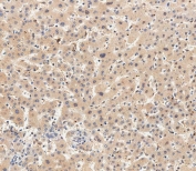 IHC testing of FFPE human liver tissue with USP15 antibody. HIER: steam section in pH9 EDTA for 20 min and allow to cool prior to staining.
