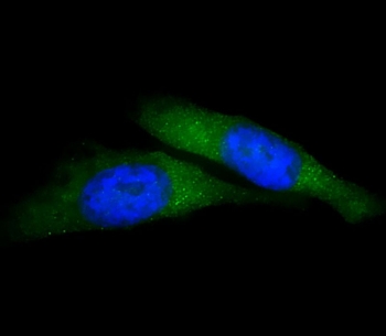 Immunofluorescent staining of fixed and permeabilized human HeLa cells with USP15 antibody (green) and DAPI nuclear stain (blue).