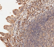 IHC testing of FFPE human epityphlon tissue with USP15 antibody. HIER: steam section in pH9 EDTA for 20 min and allow to cool prior to staining.