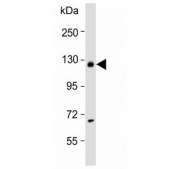 Western blot testing of human MOLT4 cell lysate with USP15 antibody. Predicted molecular weight ~112 kDa.