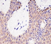 IHC testing of FFPE human skin tissue with KIF22 antibody. HIER: steam section in pH6 citrate buffer for 20 min and allow to cool prior to staining.