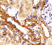 IHC testing of FFPE human kidney tissue with KIF22 antibody. HIER: steam section in pH6 citrate buffer for 20 min and allow to cool prior to staining.