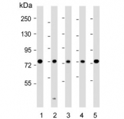 Western blot testing of human 1) MCF7, 2) HeLa, 3) SH-SY5Y, 4) Jurkat and 5) HL60 cell lysate with KIF22 antibody. Predicted molecular weight ~73 kDa.