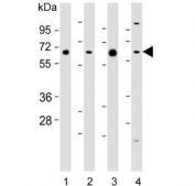 Western blot testing of 1) mouse heart, 2) human Jurkat, 3) human liver and 4) mouse testis lysate with Phosphoglucomutase 1 antibody. Predicted molecular weight: 61 kDa.
