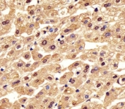 IHC testing of FFPE human liver tissue with Phosphoglucomutase 1 antibody. HIER: steam section in pH6 citrate buffer for 20 min and allow to cool prior to staining.