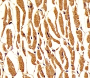 IHC testing of FFPE human heart tissue with Phosphoglucomutase 1 antibody. HIER: steam section in pH6 citrate buffer for 20 min and allow to cool prior to staining.
