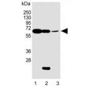 Western blot testing of 1) human liver, 2)  mouse heart and 3) human Jurkat lysate with Phosphoglucomutase 1 antibody. Predicted molecular weight: 61 kDa.