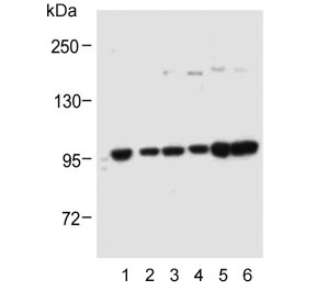 Western blot testing of human 1) A431, 2) HEK293, 3) SK-BR-3, 4) RPMI-8226, 5) MOLT4 and 6)