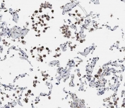 IHC testing of FFPE human lung tissue with ADAMTS17 antibody. HIER: steam section in pH9 EDTA for 20 min and allow to cool prior to staining.