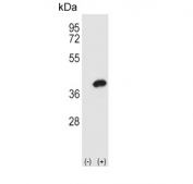 Western blot testing of 1) non-transfected and 2) transfected HEK293 cell lysate with AKR1B1 antibody.