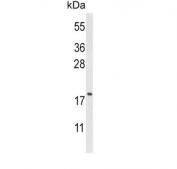 Western blot testing of human HL60 cell lysate with CFL1 antibody. Predicted molecular weight ~19 kDa.