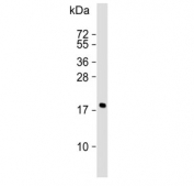 Western blot testing of human MCF7 cell lysate with CFL1 antibody. Predicted molecular weight ~19 kDa.