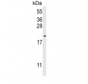 Western blot testing of mouse NIH 3T3 cell lysate with CFL1 antibody. Predicted molecular weight ~19 kDa.