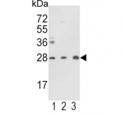 Western blot testing of human 1) Y79, 2) CCRF-CEM and 3) mouse brain lysate with TPI1 antibody. Predicted molecular weight: ~26 kDa.