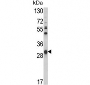 Western blot testing of human NCI-H460 cell lysate with GSTO1 antibody. Predicted molecular weight: ~28 kDa.