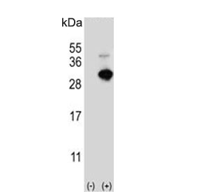 Western blot testing of 1) non-transfected and 2) transfected HEK293 cell lysate with GSTO1 antibody.