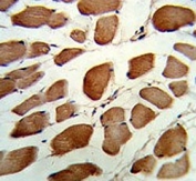 IHC testing of FFPE human skeletal muscle tissue with GSTO1 antibody. HIER: steam section in pH6 citrate buffer for 20 min and allow to cool prior to staining.