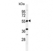 Western blot testing of mouse stomach lysate with TOX-3 antibody. Predicted molecular weight ~63 kDa.