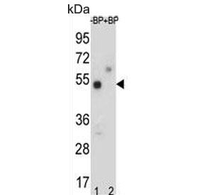 Western blot testing of mouse lung lysate in the absence and presence of immunizing peptide, using TOX-3 antibody. Predicted molecular weight ~63 kDa.