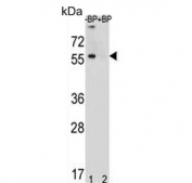 Western blot testing of human MDA-MB453 lysate in the absence and presence of immunizing peptide, using TOX-3 antibody. Predicted molecular weight ~63 kDa.