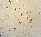 IHC testing of FFPE human brain tissue with RagD antibody. HIER: steam section in pH6 citrate buffer for 20 min and allow to cool prior to staining.