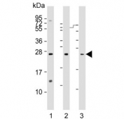 Western blot testing of human 1) breast, 2) kidney and 3) lung lysate with Adrenomedullin antibody.
