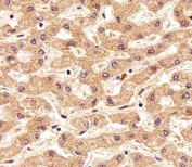 IHC testing of FFPE human liver tissue with FOLH1B antibody. HIER: steam section in pH6 citrate buffer for 20 min and allow to cool prior to staining.