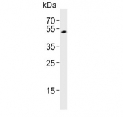 Western blot testing of human kidney lysate with FOLH1B antibody. Predicted molecular weight ~50 kDa.