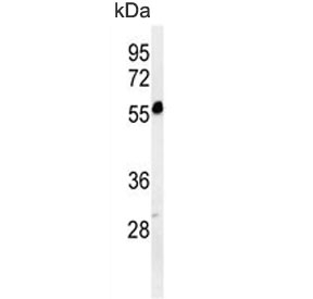 Western blot testing of human K562 cell lysate with FOLH1B antibody. Predicted molecular weight ~50 kDa.