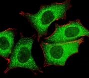 Immunofluorescent staining of human MCF7 cells with TENT2 antibody (green) and anti-Actin (red).