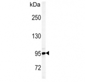 Western blot testing of human HEK293 cell lysate with JHDM1D antibody.