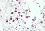 IHC testing of FFPE human testis tissue with JHDM1D antibody. HIER: steam section in pH6 citrate buffer for 20 min and allow to cool prior to staining.