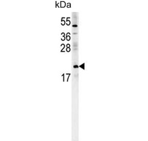Western blot testing of human K562 cell lysate with Pro-MCH antibody.