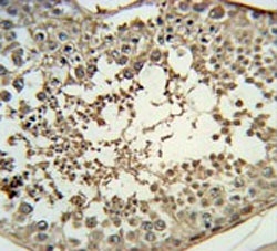 IHC testing of FFPE human testis tissue with Pro-MCH antibody. HIER: steam section in pH6 citrate buffer for 20 min and allow to cool prior to staining.