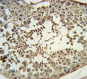 IHC testing of FFPE human testis tissue with Pro-MCH antibody. HIER: steam section in pH6 citrate buffer for 20 min and allow to cool prior to staining.